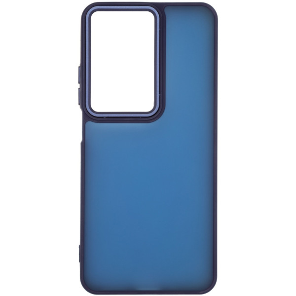 Фото - Чехол для смартфона Armorstandart Frame for Realme C75 4G / C75x 4G Blue (ARM86094) Фото - Чехол для смартфона Armorstandart Frame for Realme C75 4G / C75x 4G Blue (ARM86094)