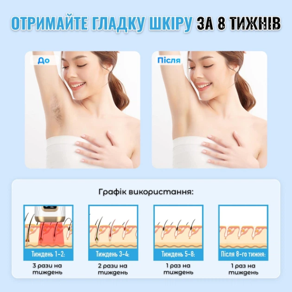 Фото - Фотоэпилятор INSPIRE W-1095A White