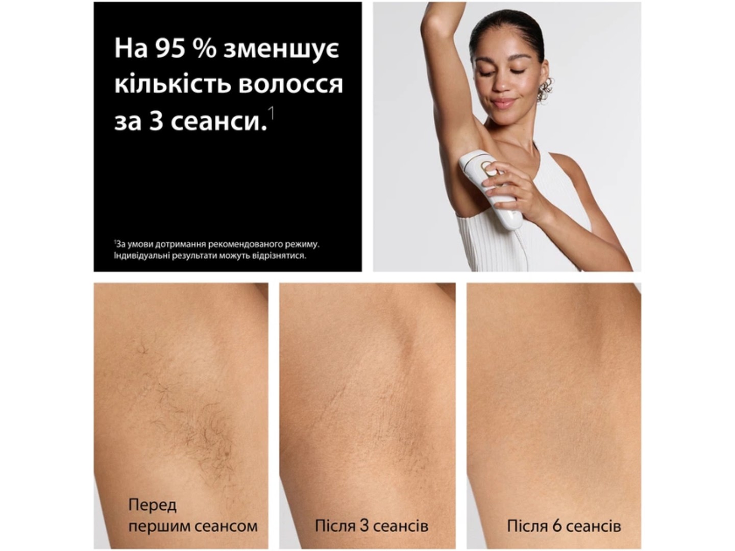 Фотоепілятор Braun Silk Expert Pro 5 PL5412 + Тример для обличчя + Бритва Gillette Venus Extra Smooth + Косметичка (8700216938006) — фото 3