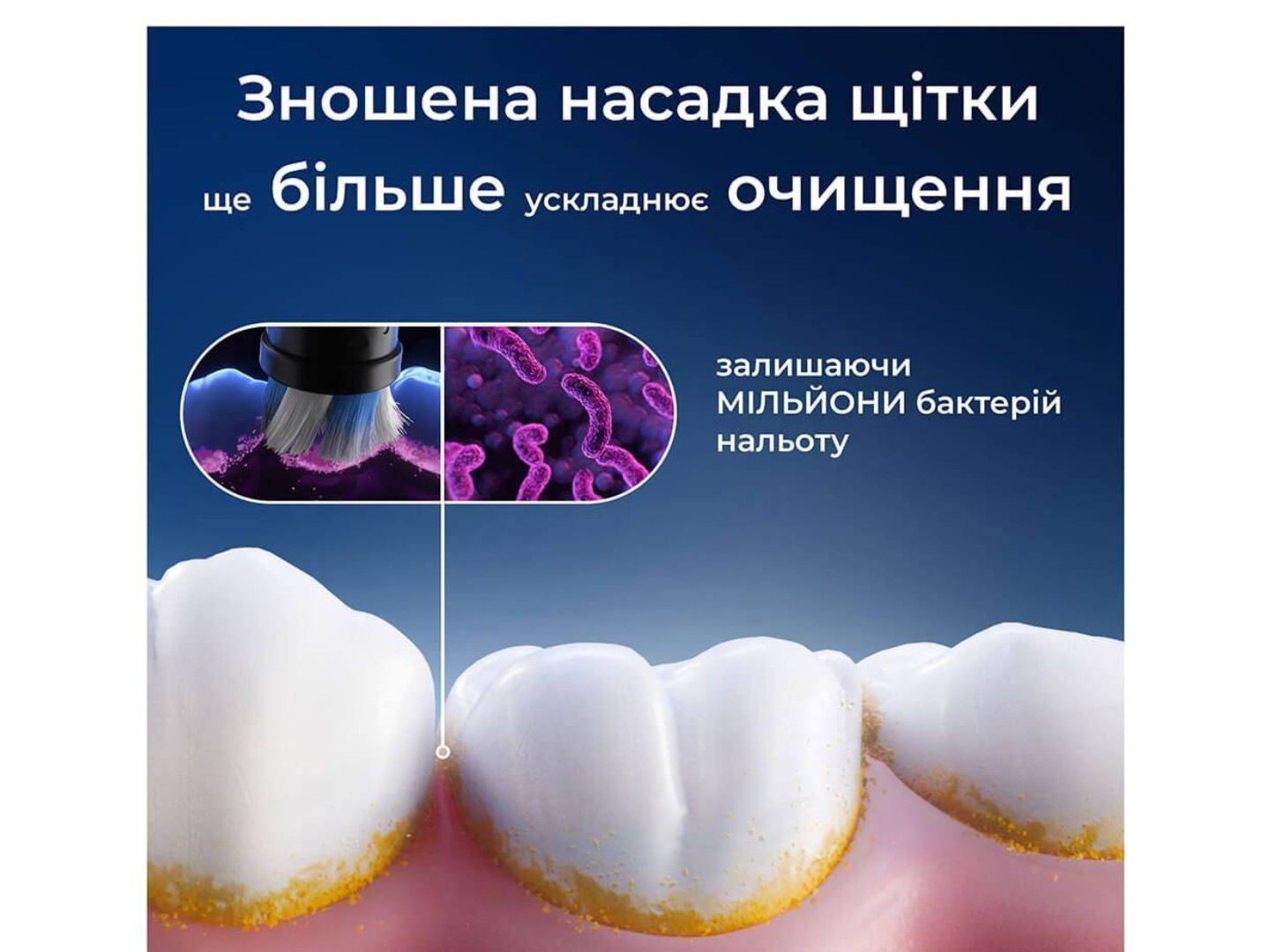 Насадка для зубної щітки Oral-B Braun iO Gentle Care Black 4 од — фото 4