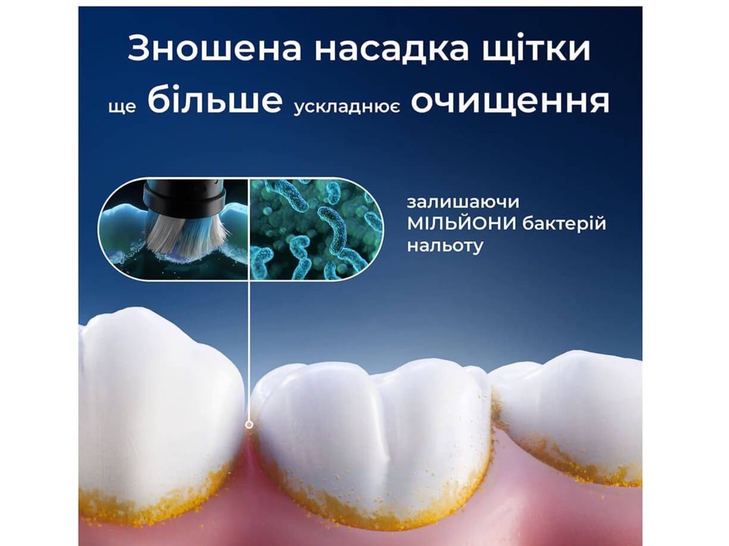 Насадка для зубної щітки Oral-B Braun iO Спеціалізоване чищення 2 од — фото 8