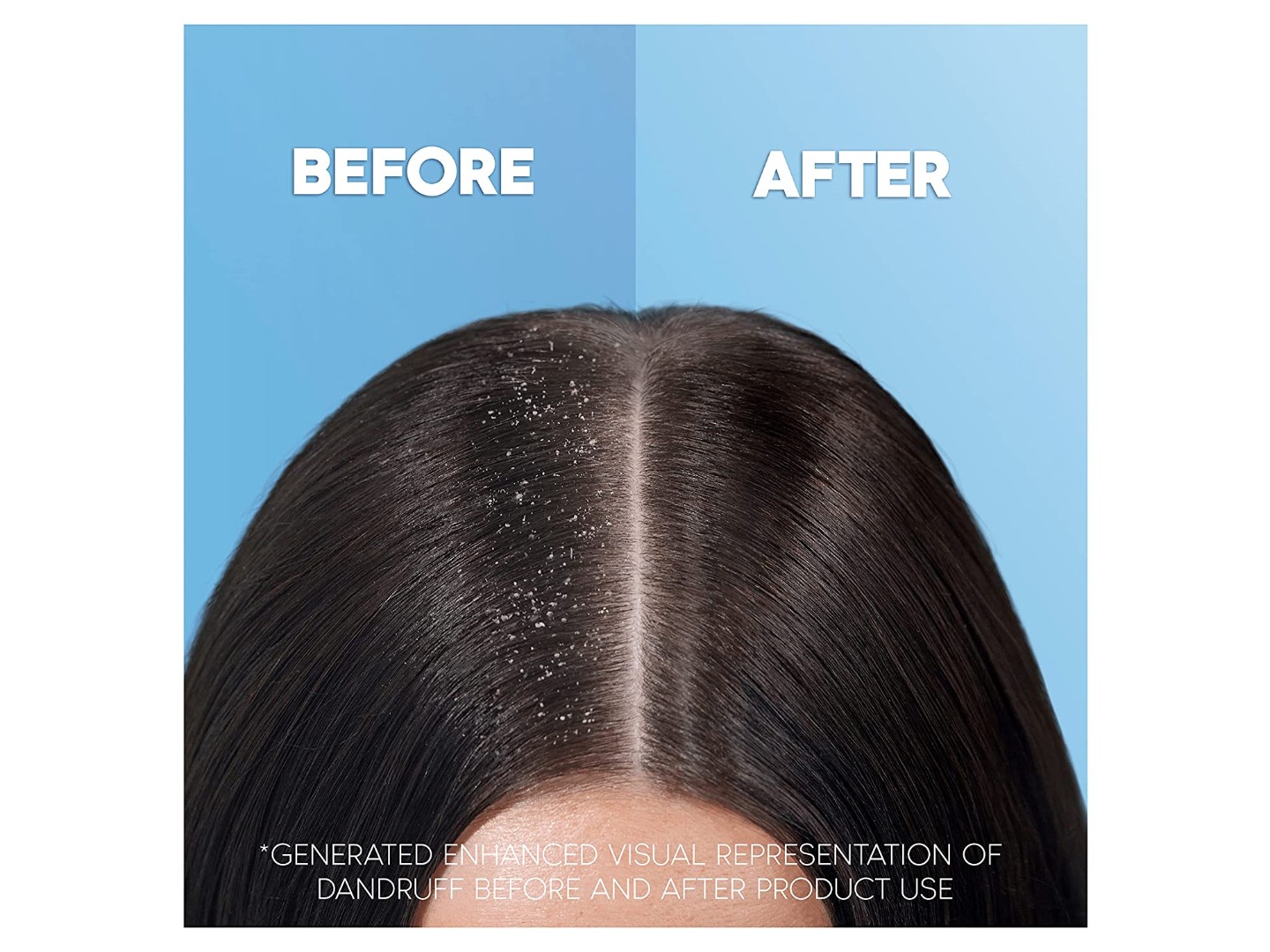 Шампунь жіночий Head&Shoulders проти лупи Яблучна свіжість 400мл — фото 9