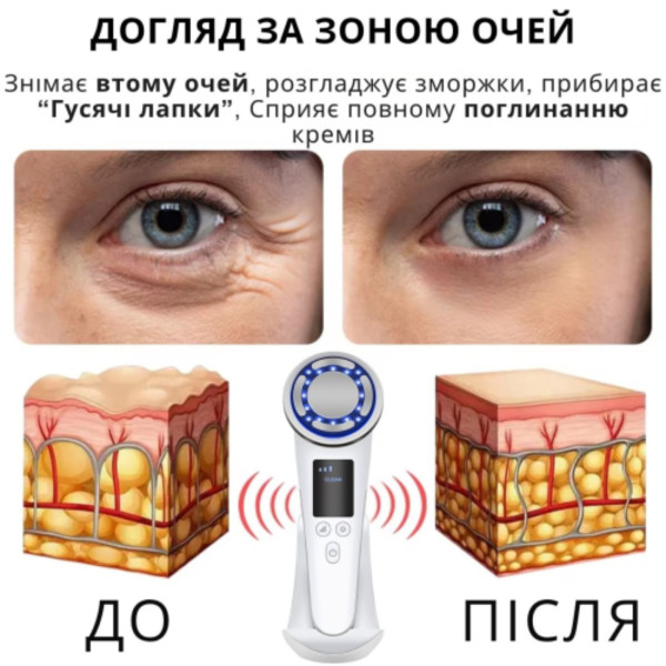 Фото - Масажер для обличчя AIMED SkinLift Pro Anti-Aging RF Lifting, Hot&Cold EMS+LED (AI-EMS_Pro_wh)