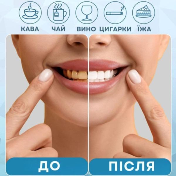 Фото - Гель для зубів AIMED Smile Gel 3 шт. (AI-SmileGel3)