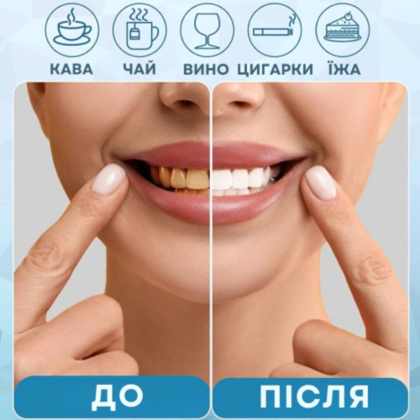 Фото - Зубна капа AIMED Smile Kit Pro 3 шт. (AI-SmileKit_set_1)