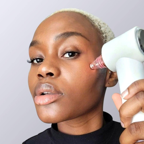 Фото - Прибор для чистки лица AIMED Pore Cleaner Hot&Cold білий (AI-PCleaner_Gen2_wh)