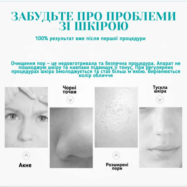 Фото - Прилад для чищення обличчя AIMED PORE CLEANER MINI (AI-PoreCleanerMiniWh)