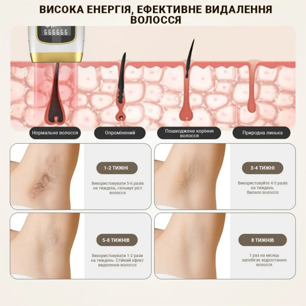 Фото - Фотоепілятор INSPIRE Sapphire XM-L011W