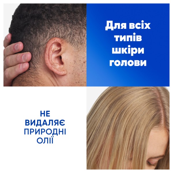 Фото - Шампунь мужской Head&Shoulders Цитрусовая свежесть 400 мл (5011321336032)