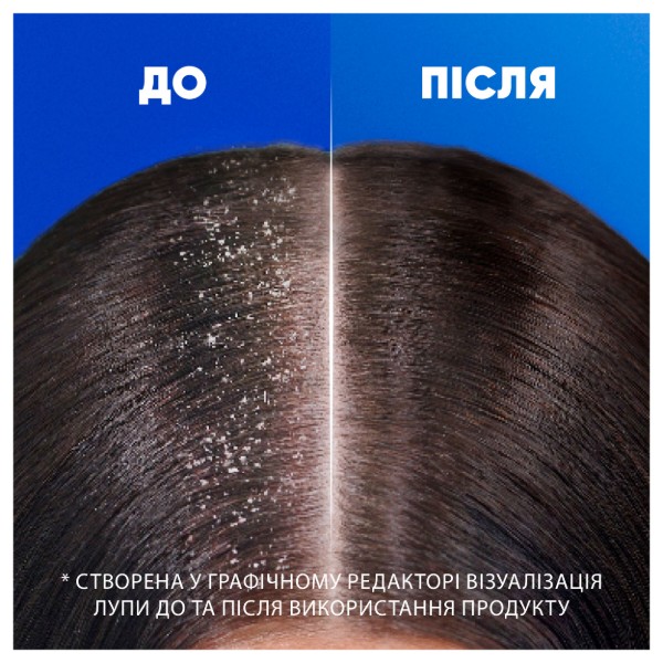 Фото - Шампунь мужской Head&Shoulders Цитрусовая свежесть 400 мл (5011321336032)