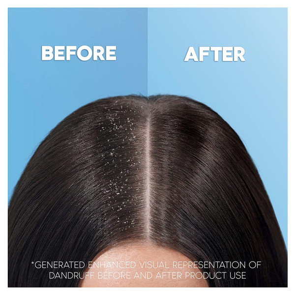 Фото - Шампунь жіночий Head&Shoulders проти лупи Яблучна свіжість 400мл