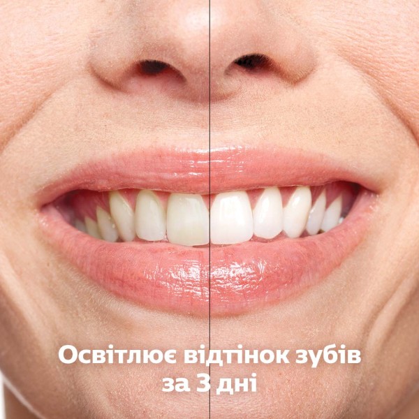 Фото - Зубна щітка електрична Philips HX9917/89