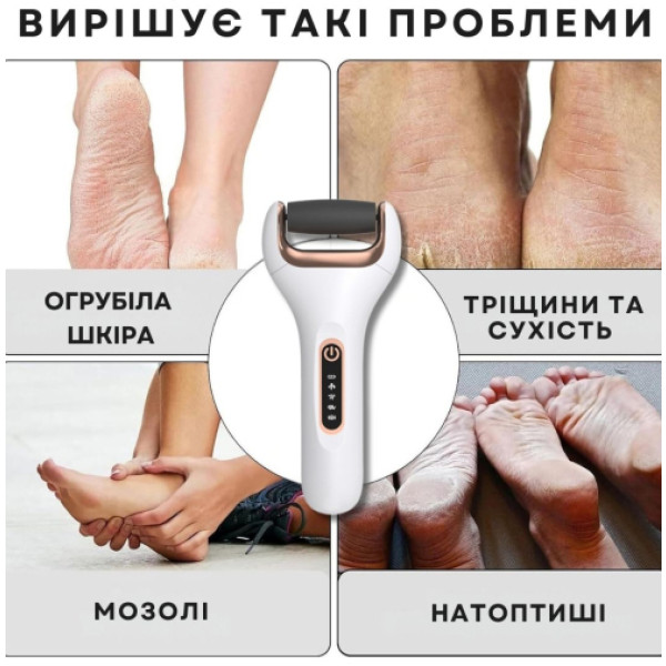 Фото - Електрична роликова пилка AIMED Foot Master Classic (AI-FootM_Classic1_wh)
