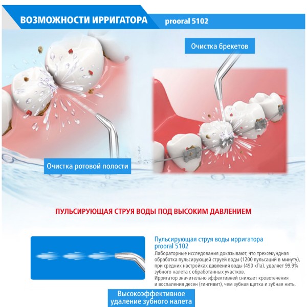 Фото - Ирригатор Prooral 5102