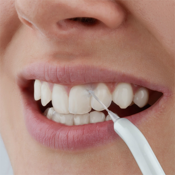 Фото - Іригатор Sencor SOI1100SL