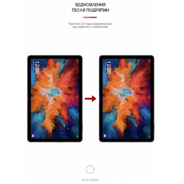 Фото - Захисна плівка для планшету Armorstandart for Umidigi A11 Tab (ARM65355)