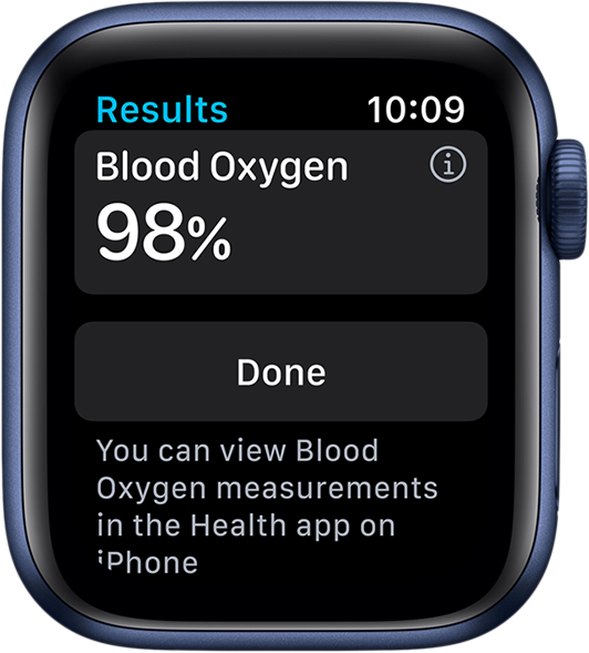 Фото Смарт-часы Apple Watch Series 6 - 5